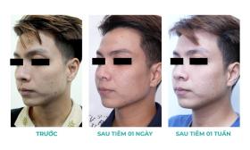 Hội nghị khoa học ứng dụng Belotero Revive trong thẩm mỹ da