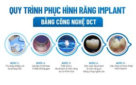 Công nghệ phục hình răng sứ trên implant DCT