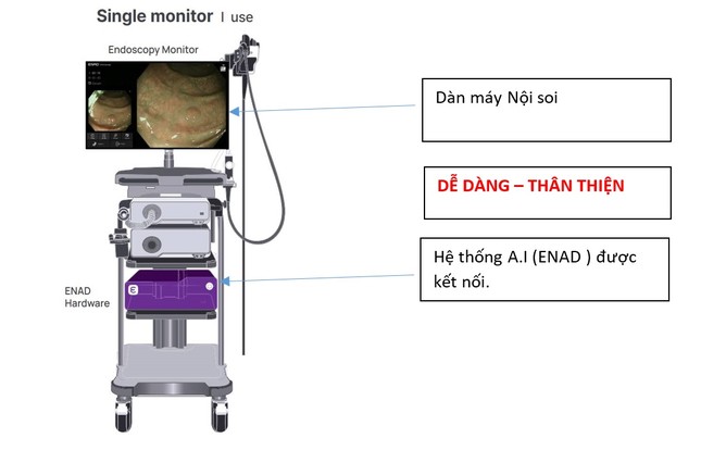  Những khả năng phi thường của A.I trong nội soi tiêu hóa 